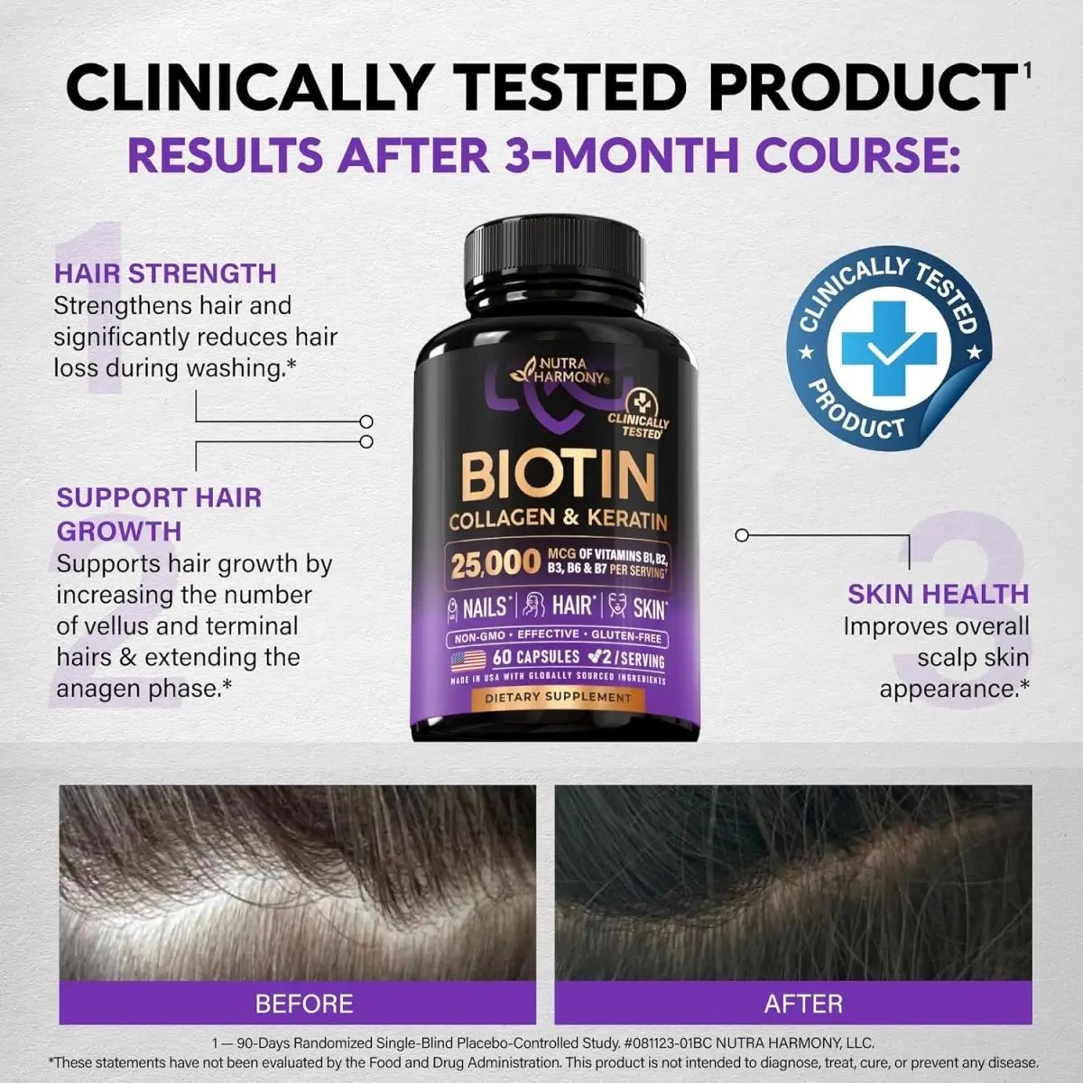 Biotin Collagen Keratin Complex Hair Skin & Nail Support - ToxiTress Hair Experience