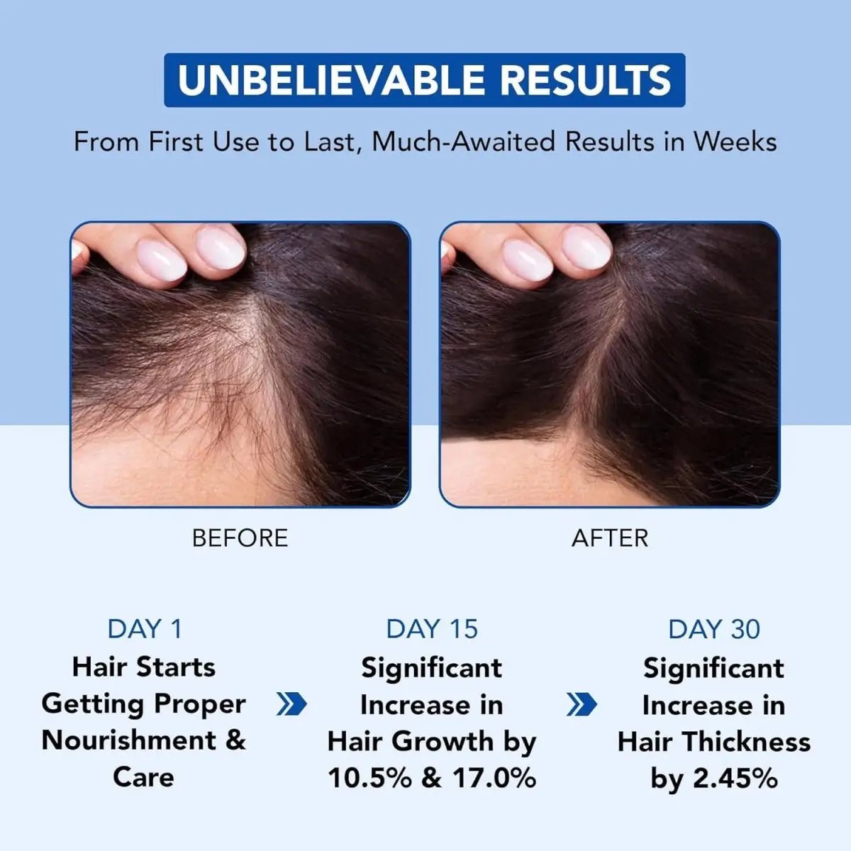 Rosemary Hair Oil for Hair Growth with Biotin & Castor - ToxiTress Hair Experience