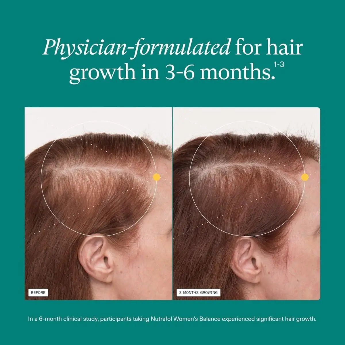 Women’s Hair Growth Supplement 45+ – Thicker, Fuller Hair - ToxiTress Hair Experience